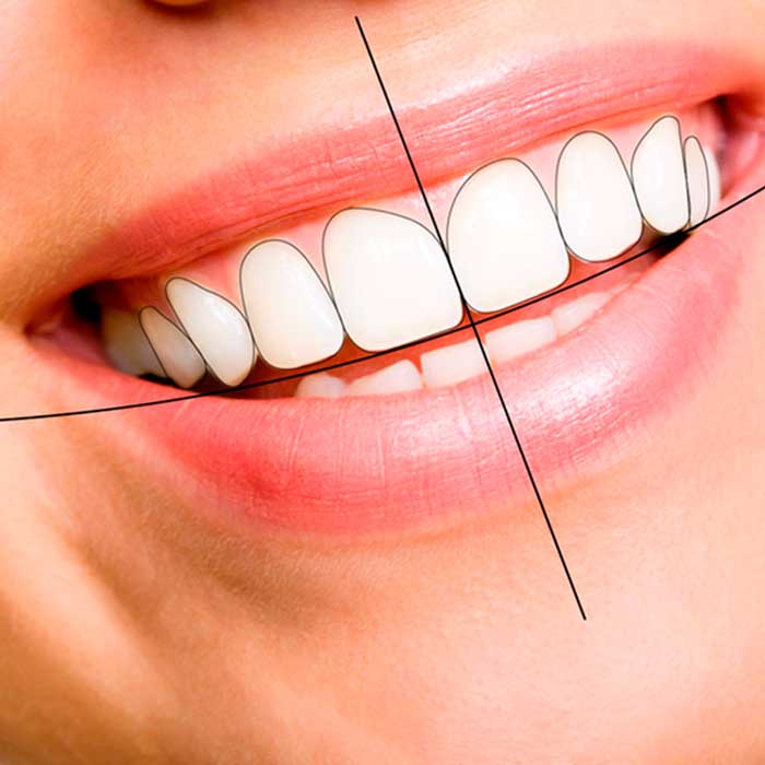diseno sonrisa dentalix cucuta