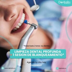 CUADRADO PROMO DE LIMPIEZA+BLANQUEAMIENTO NOVIEMBRE 2025