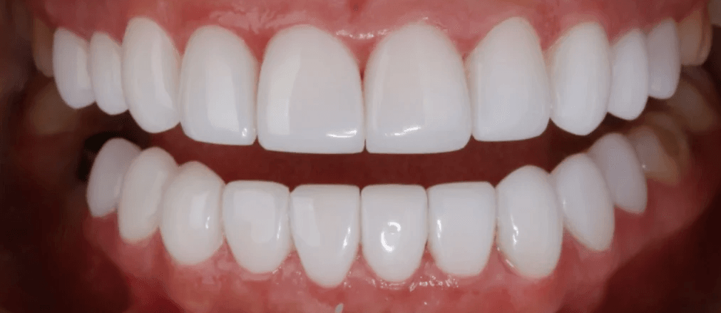 ¿Cuánto cuesta un diseño de sonrisa en Cúcuta?
