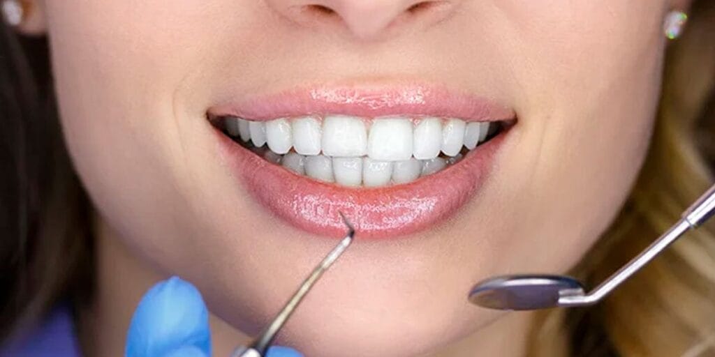 Cuánto vale una resina dental en Cúcuta