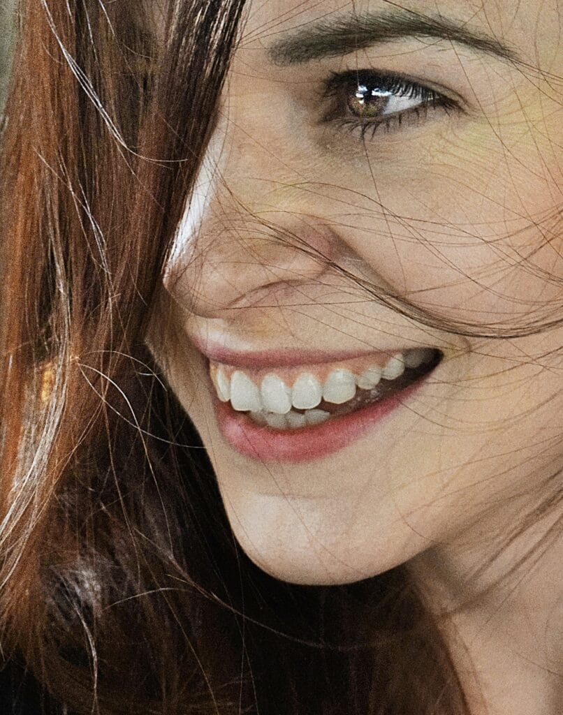 Diseño de sonrisa natural en Cúcuta precio