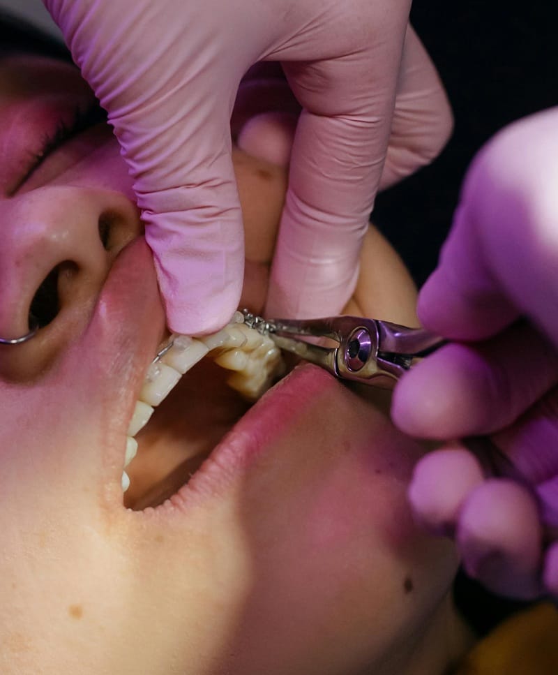 Tratamientos dentales financiados en Cúcuta