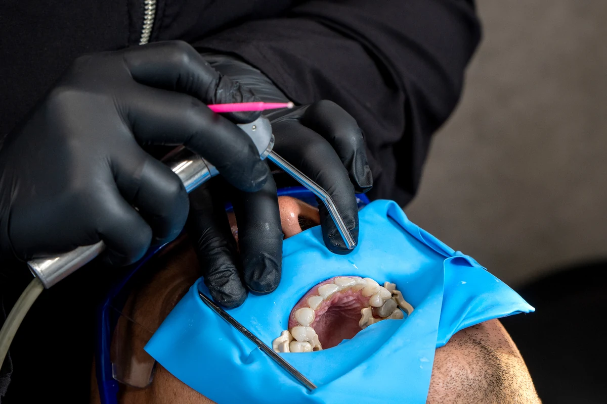 Diseño de sonrisa en Cúcuta - especialista de Dentalix trabajando en una sonrisa con técnica CAD/CAM